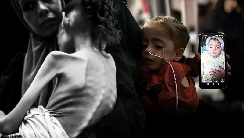 25 Kilodan 10 Kiloya Düşen Küçük Meryem'in Açlıkla Mücadelesi