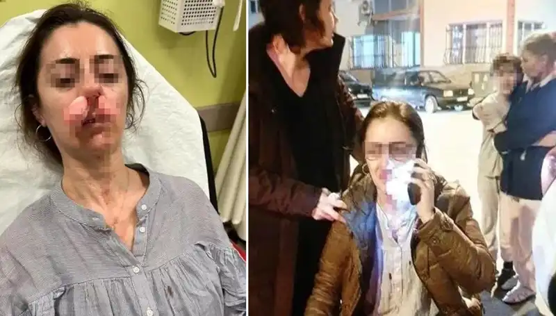 Kadın Eşinin Sevgilisini Arabanın Kapısıyla Saldırdı: Olayın Perde Arkası